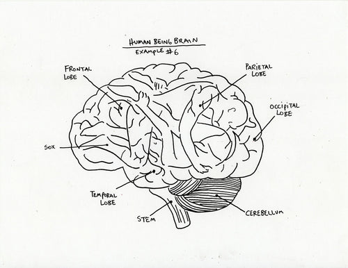 HUMAN BRAIN EXAMPLE #6