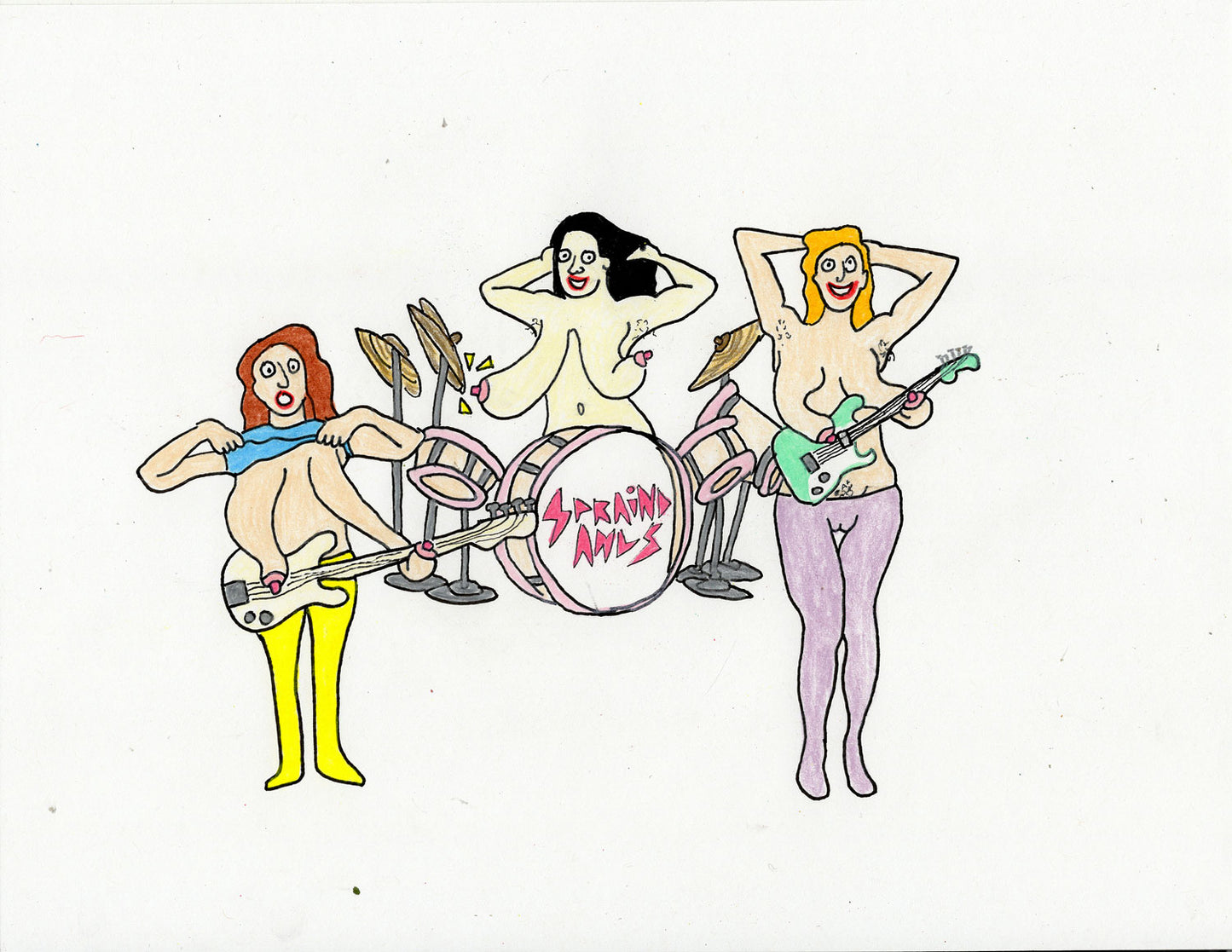 SPRAIND ANUS BAND